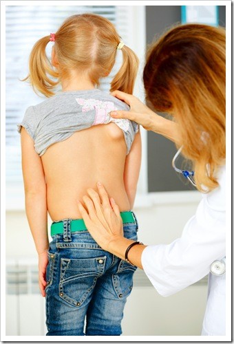 Scoliosis New Fairfield CT Pain Relief