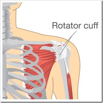 Shoulder Pain New Fairfield CT Rotator Cuff Injury